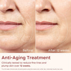 7 Color LED Mask: Anti-Aging & Acne