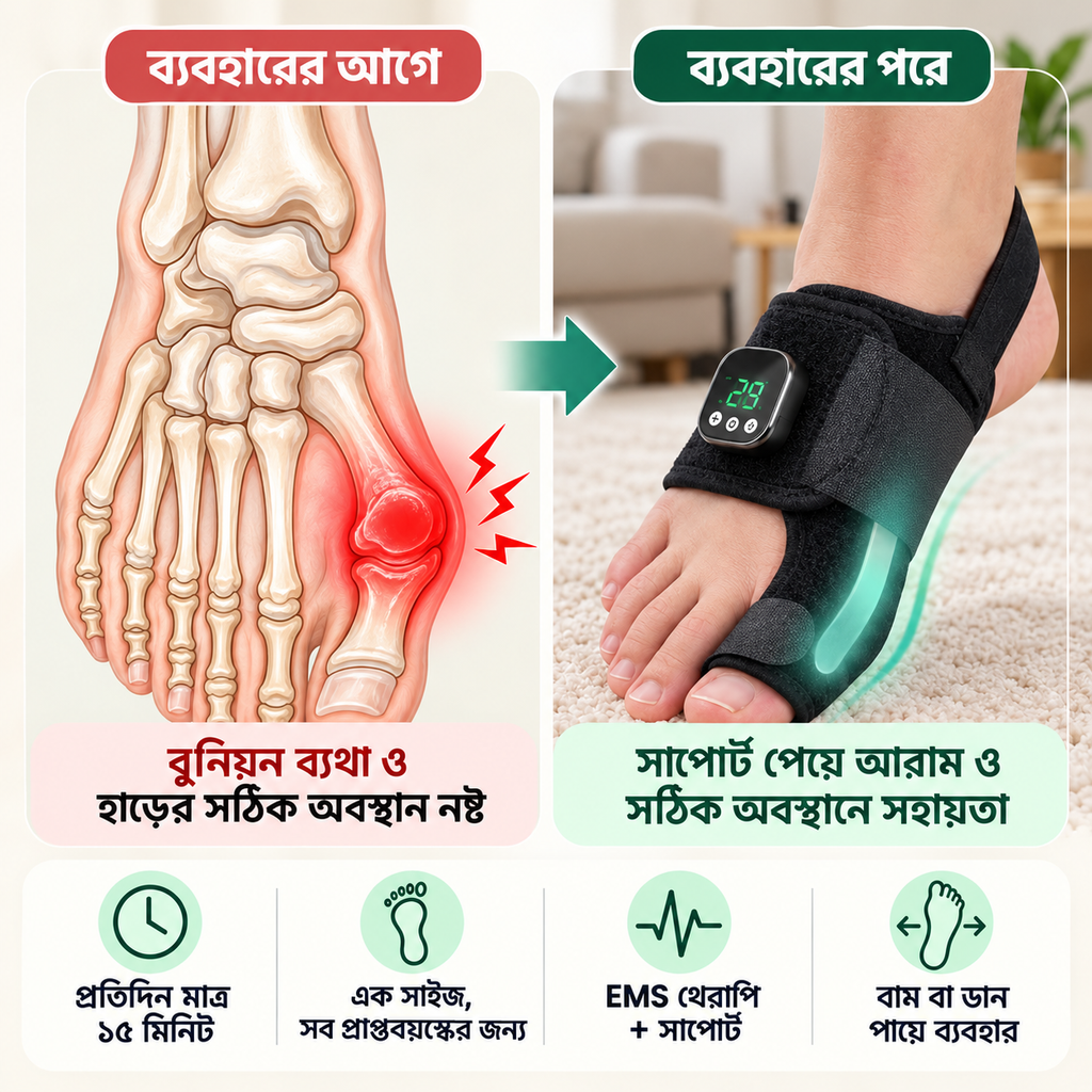 EMS Bunion Corrector